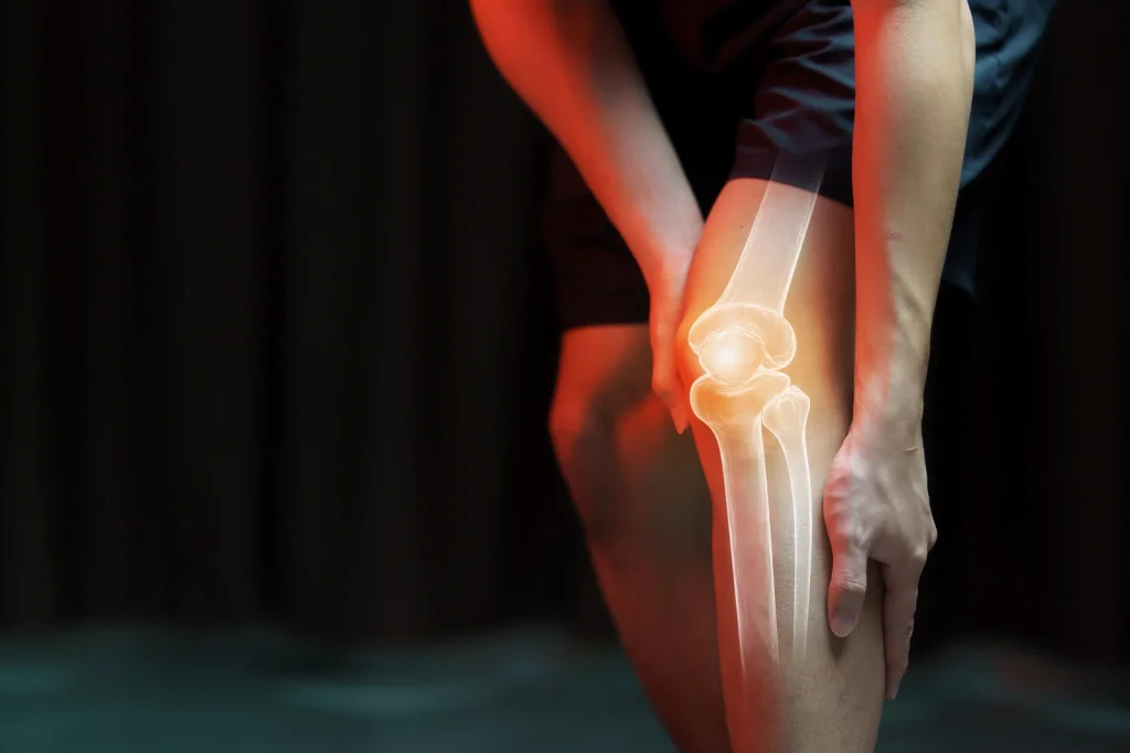 Runners Knee